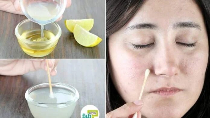 Easily Remove Dark Spots with Lemon Juice: A Natural Remedy Guide